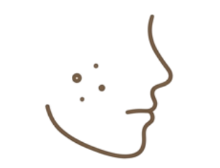 にきび・肌荒れ
