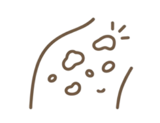 発疹・じんましん